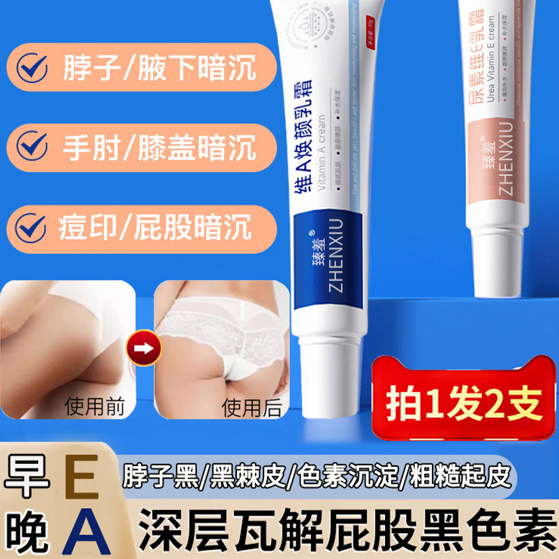 屁股去黑坐印大腿内侧祛除黑色素沉淀，79元能解决这些烦恼吗？_护肤品
