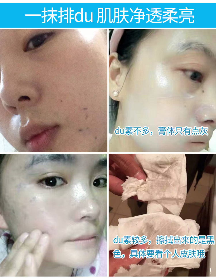 Hàng sâu massage du kem massage kem mặt facial kem massage yan yan class để vàng tự nhiên m trắng kem massage mặt ohui
