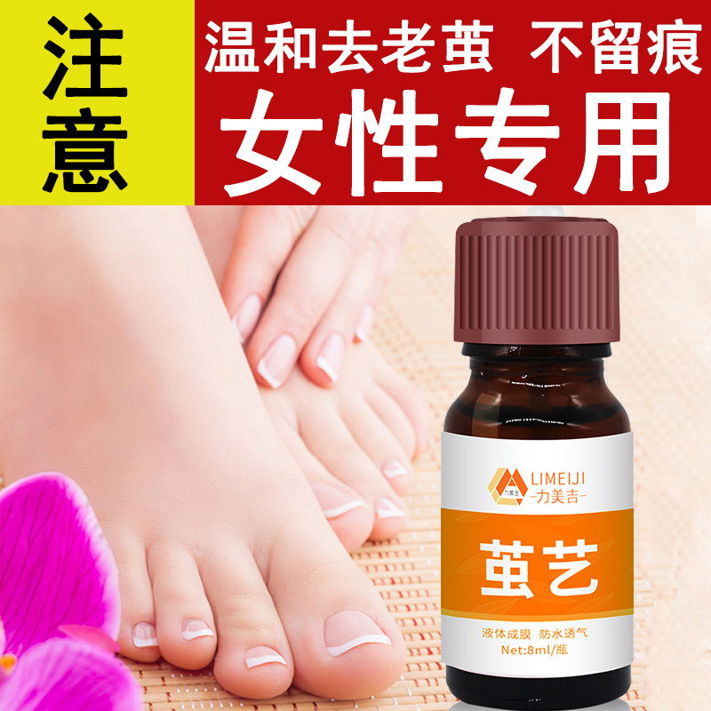 Sole and old cocoon dead skin cocoon Cocoon God Sole Cream Hands Stiff Leather Old Leather Cocoon Clear Non removal Non-softener