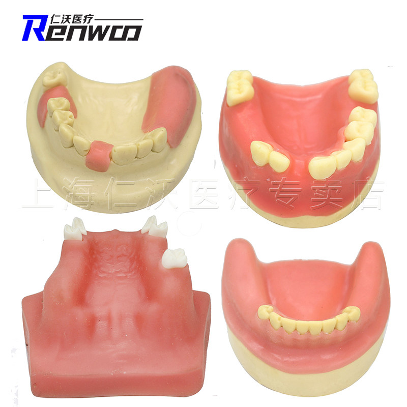 Dental implant practice model Maxillary sinus exercise Soft gum model Oral model Dental material