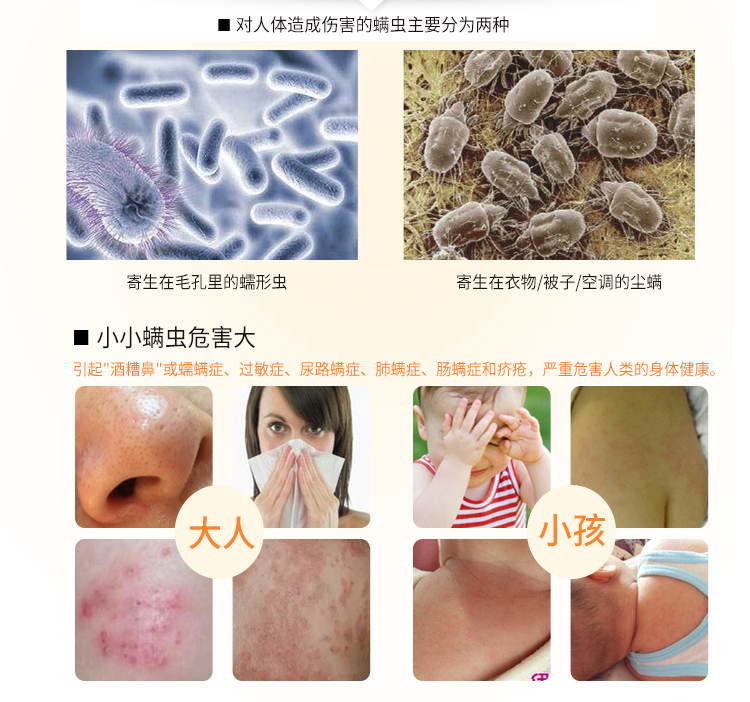 bình xịt côn trùng chính hãng	 Ngoài giường phun mạt, vật dụng khử trùng dùng một lần, diệt phun sương, chống mạt, ve, xác thực - Thuốc diệt côn trùng giá thuốc xịt muỗi
