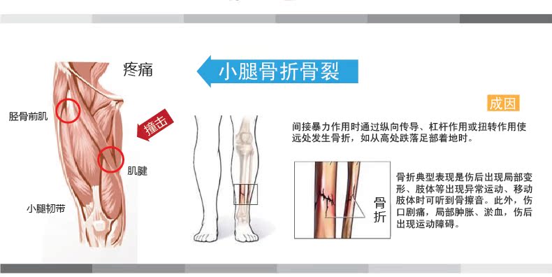 Kang Ma Shi xà cạp thoáng khí điều dưỡng bê chạy bộ chấn thương thể thao bóng rổ bóng chuyền bảo vệ chân bóng chuyền nam và nữ - Dụng cụ thể thao găng tay chống nắng nam cao cấp
