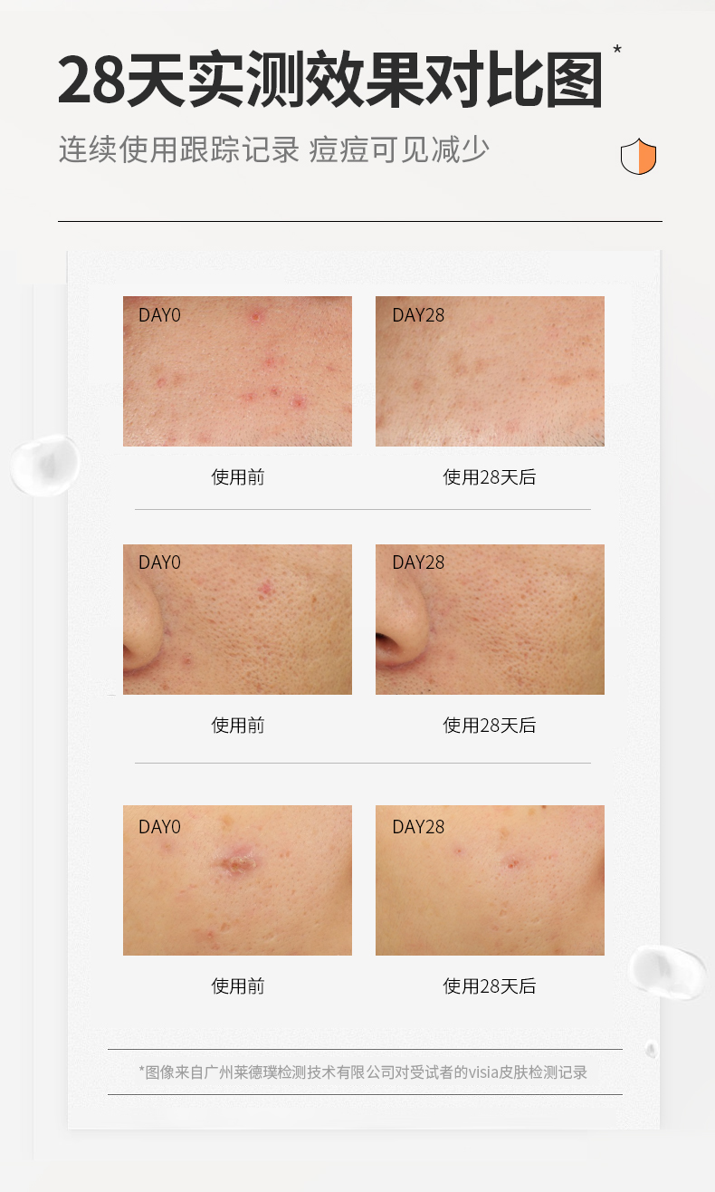 日本进口 花印 抗痘去印凝露 25g 图4