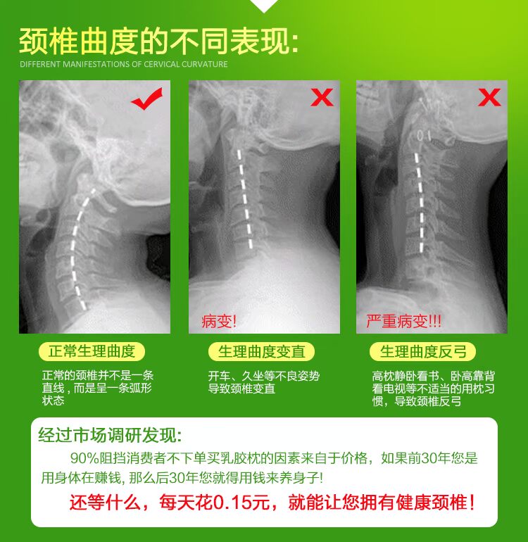 Thái Lan gối cao su mua Ubreathing chính hãng Bạn phải nghĩ đến việc gối cao su thiên nhiên chăm sóc sức khỏe cổ tử cung - Gối gối ôm dài