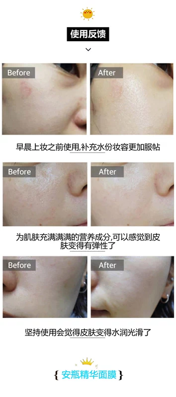 Lâm Vân khuyên! Wonjin Yuanchen Yuanchen Hyaluronic Acid Ampoule Essence Mặt nạ dưỡng ẩm Treo Chai Mặt nạ trẻ hóa mặt nạ nhau thai cuống rốn