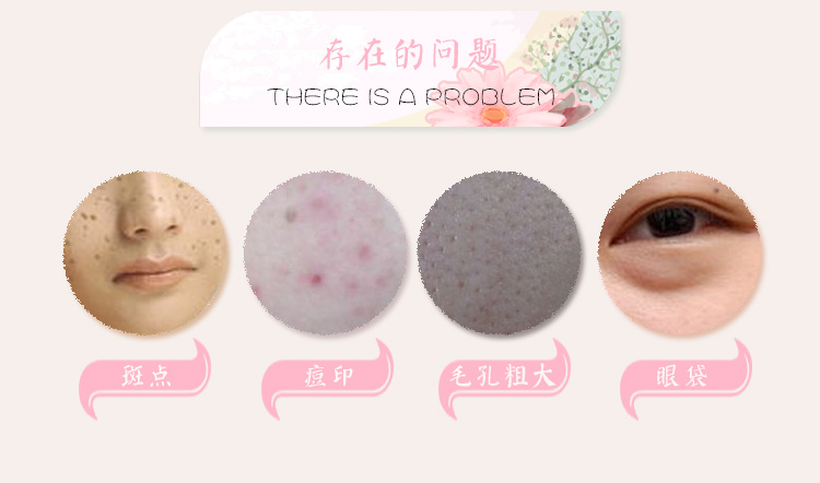 Mạnh mẽ kem che khuyết điểm bút bìa kem quầng thâm mắt túi mụn marks lip cơ sở giữ ẩm kem che khuyết điểm dính lỏng kem nền và kem che khuyết điểm