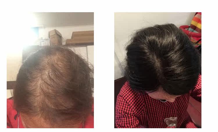 Extension cheveux - Ref 225896 Image 35