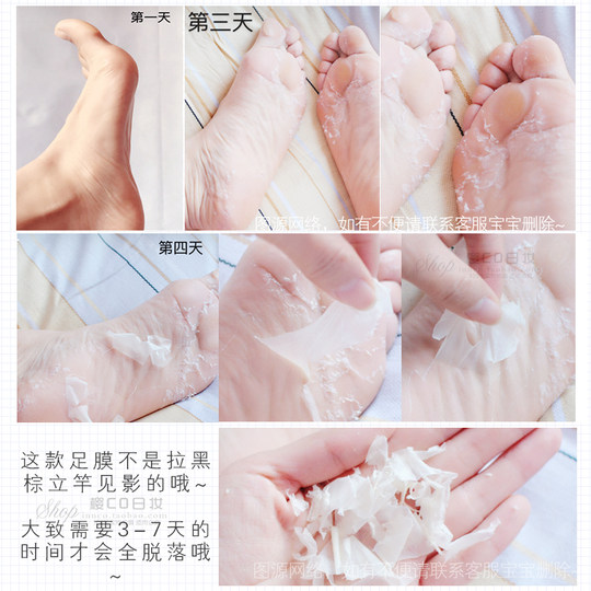 日本MiiMeow咪一喵乳酸脚膜去死皮角质脚皮老茧后跟干裂脱皮足膜