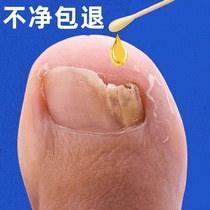 Tong Ren Tang sells 100000 yuan. One drop will turn bad nails into good nails. Bad potassium nemesis. Repair fingers and toes and turn them into good ones. Potassium