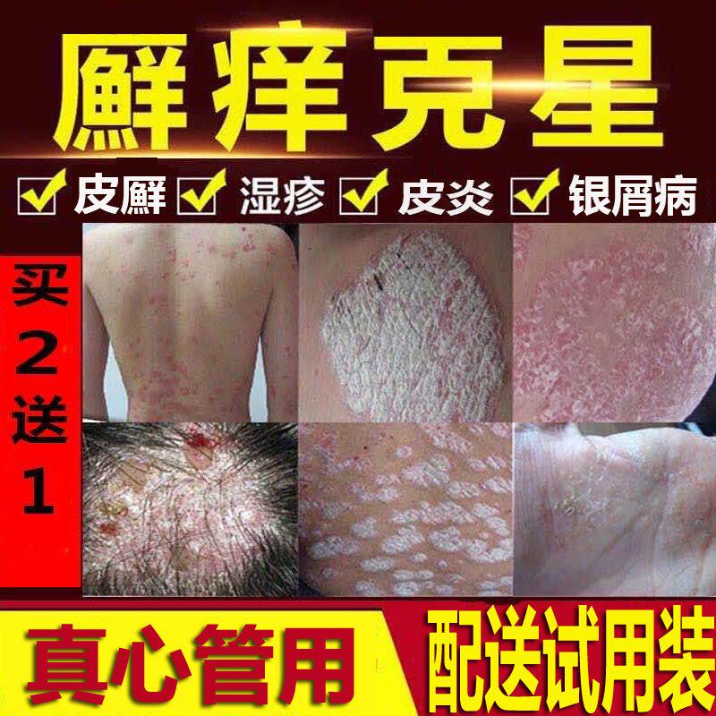 Shu 1 Extreme Moss Standing 1 gr Blistering Eczema Psoriasis Psoriasis Ointment to Sterilize The Medical Grade of Dermatophyte