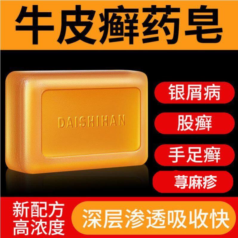 Drug Soap Psoriasis Wash head urticaria Eczema Anti-Itch Cow Leather Special Drug Allergy Chronic Biliary Urticaria