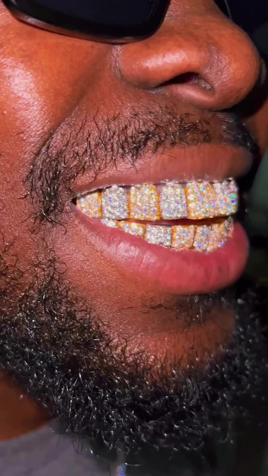 3d Printed Dental Mold Full Bust Down Style Iced Out Moissanite Grillz
