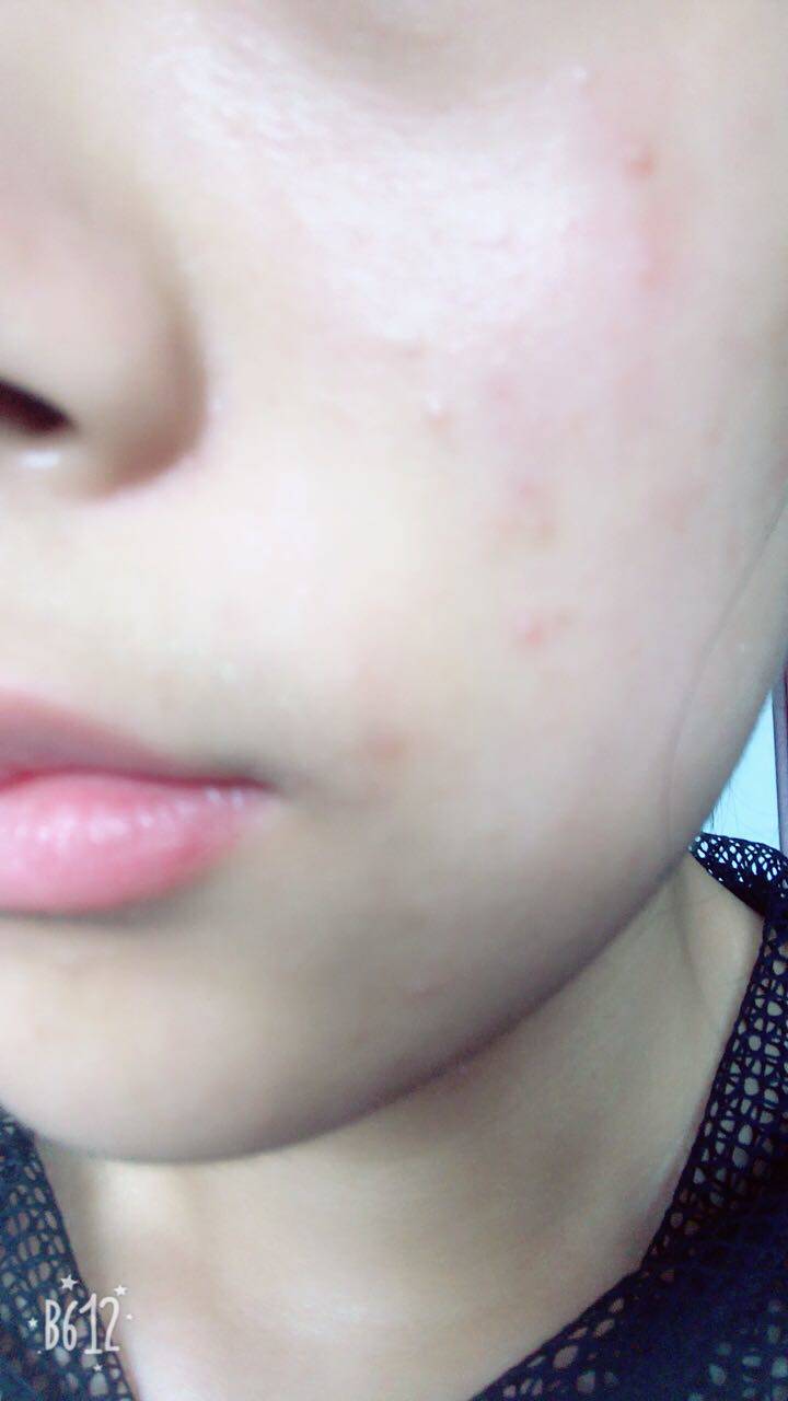 相宜本草红景天莹透幼白精华乳!