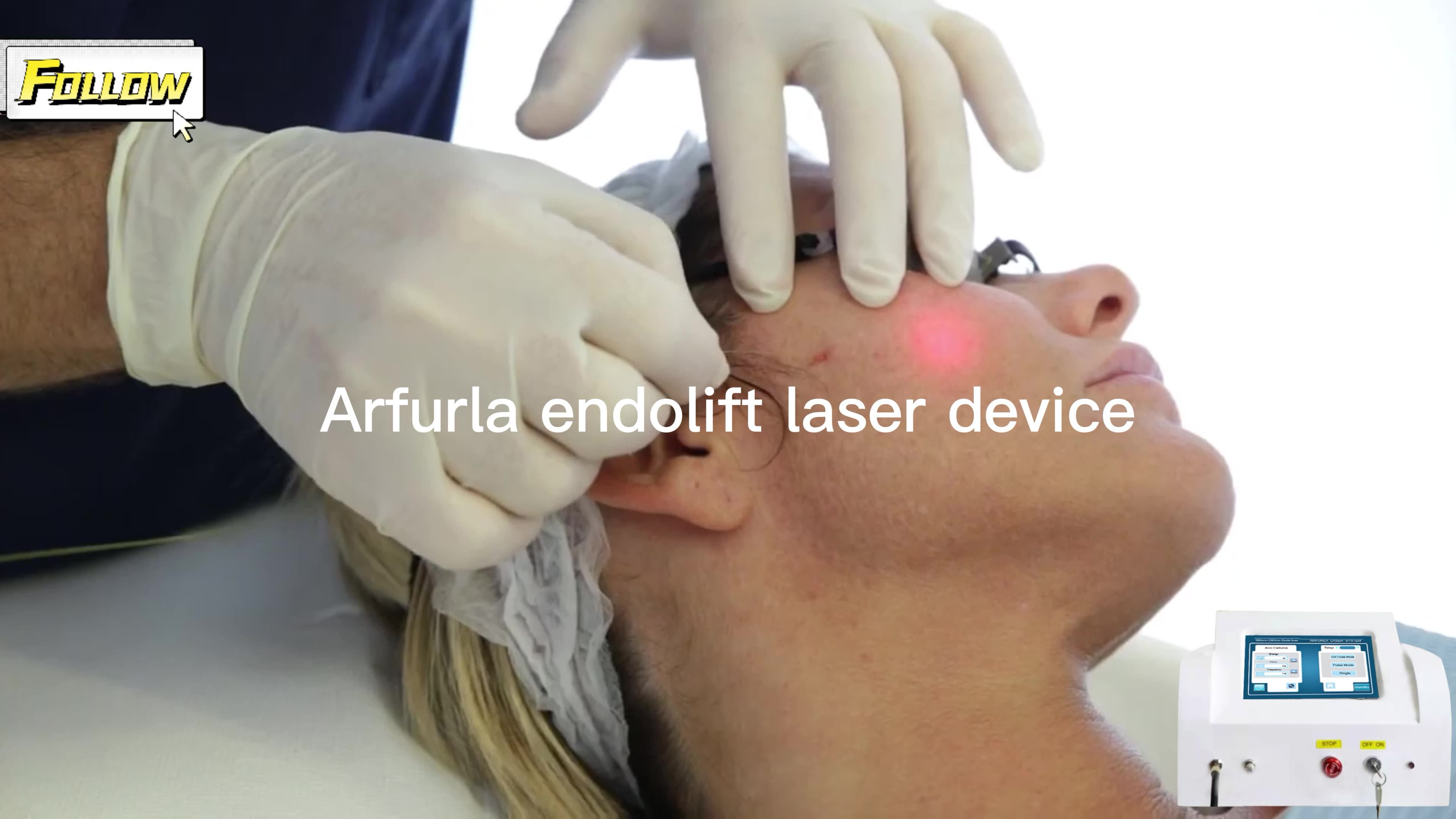 Endolift Laser Dual 1470nm+980nm Lifting Lipo Arfurla Lipolysis Surgery