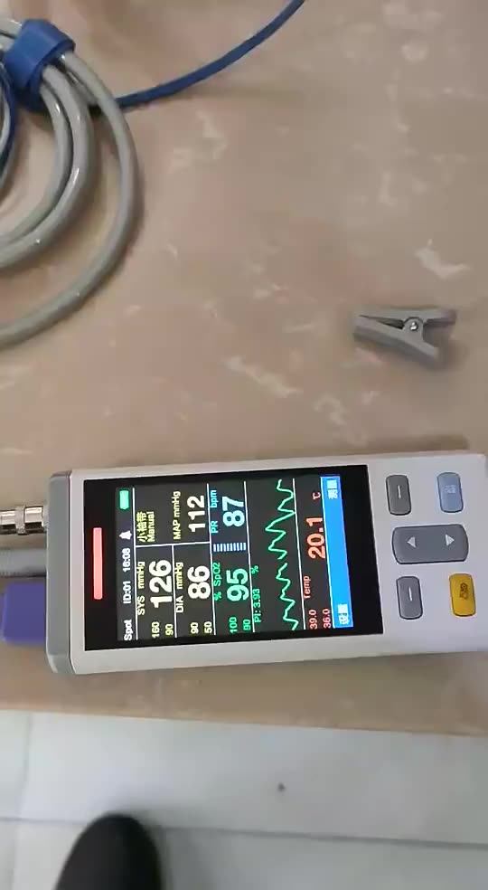 Ddp Veterinary Multiparameters Ecg Etco2 Handheld Pet Hospital