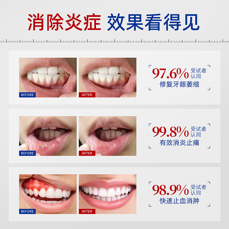医用漱口水:对抗口腔顽疾的秘密武器