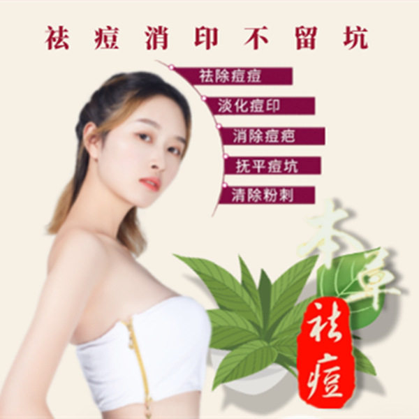 苗山斗豆液专业祛痘护肤