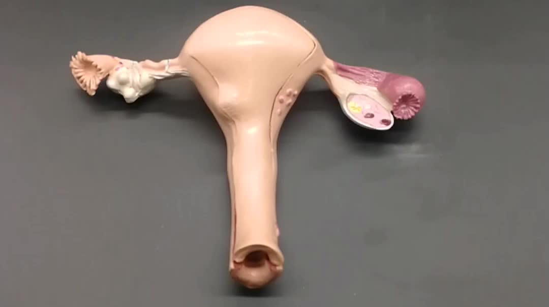 Anatomical Normal Female Reproduction System Uterus Model - Buy