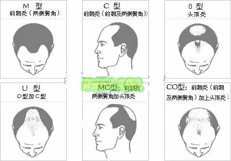 Extension mèches - Ref 225713 Image 37