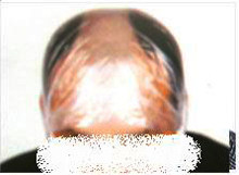 Extension mèches - Ref 225713 Image 51