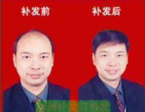 Extension mèches - Ref 225713 Image 35