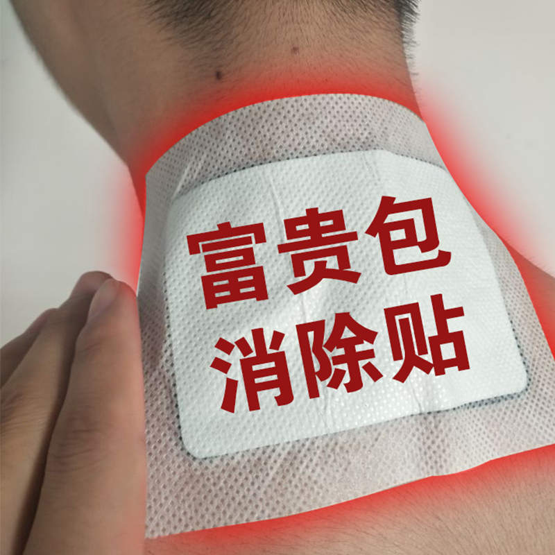 Treat the rich and expensive bag elimination post special hot compress patch dredge the neck pain deity of the cervical spine