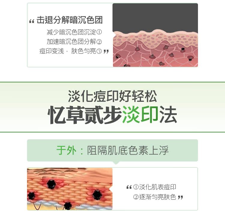 Nhắc lại cỏ đích thực kem trị mụn in mụn mụn trứng cá mụn trứng cá sửa chữa mụn lô hội kem dưỡng kiehl's