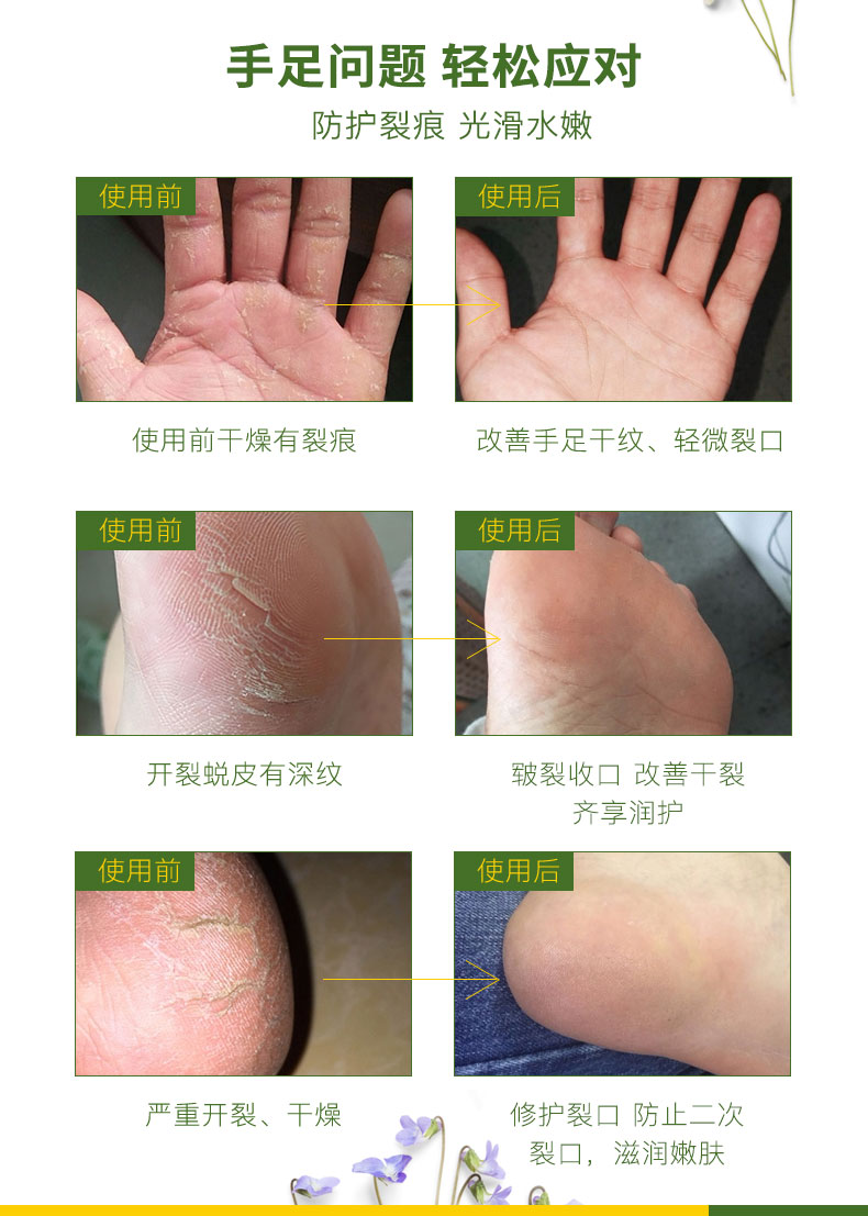 Chống nứt Chân Kem Gót Chống khô Giữ Ẩm Dưỡng Ẩm Chân Kem Chăm Sóc Bàn Chân Kem Chân Tẩy Tế Bào Chết Foot Cream tẩy tế bào chết chân