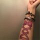 Flower-armed girl's bandage has two tattoo stickers