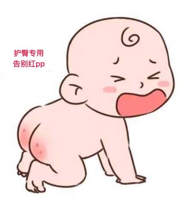 Hip cream 20g red ass special shot hyperlink Xi to baby ten-year-old brand