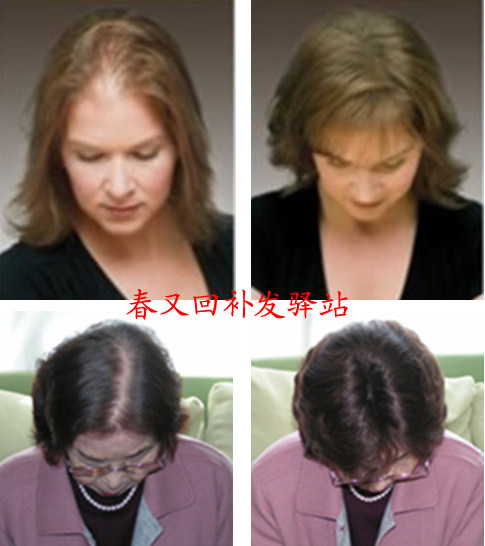 Extension cheveux - Ref 224965 Image 13