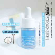 Eliminate the muscle bottom natural unbounded German Blue Chamomile repair essence oil acne anti-sensitivity repair muscle bottom