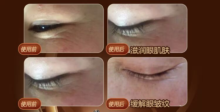 Laiwu mắt thiết lập hộp kem mắt bạch kim cổ điển bộ chăm sóc quầy xác thực để quầng thâm để mắt túi quạ chân mặt nạ mắt