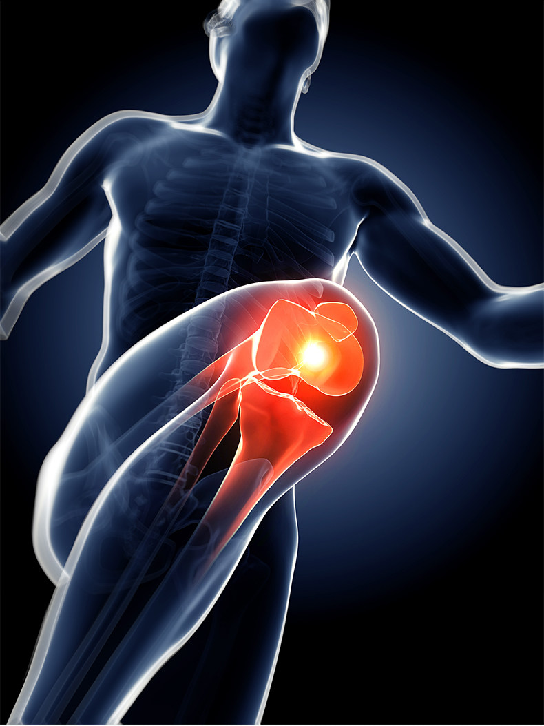 Protection sport - Ref 592781 Image 10