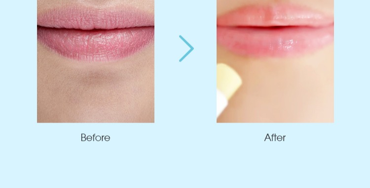 DAISY SKY Daisy Sky Sky Aromatheracco Plant Brightening Lip Balm Giữ ẩm cho môi son dưỡng gucci