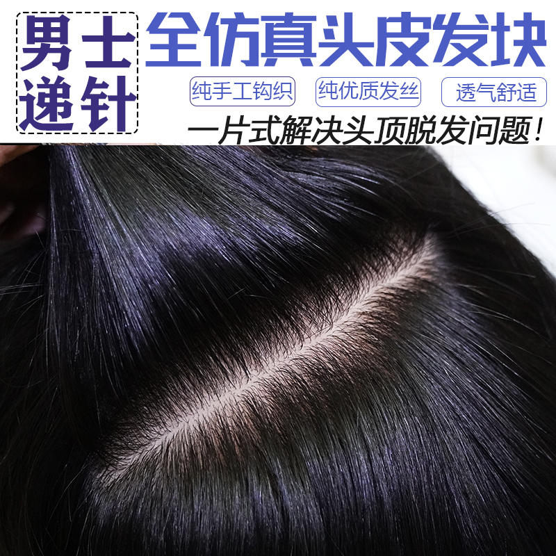 New product men's and women's hair loss baldness needle bio-simulation scalp invisible breathable markless additional hair patch
