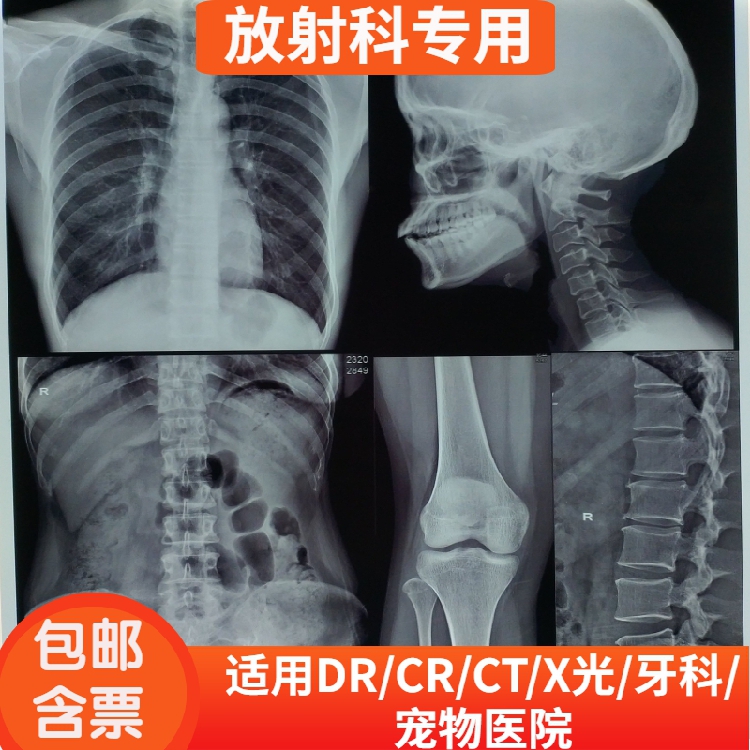 Dry Wipe Blue Base Sheet Medical Radionegatives DR CR CT X-ray Nuclear Magnetic Resonance Tooth Sheet Inkjet Blue