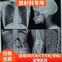 Dry blue-based film Medical film Radiation DR CR CT X-ray film MRI dental film Inkjet blue film