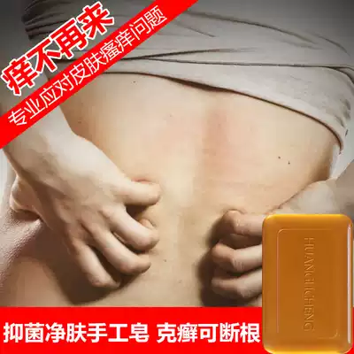 Men and women's private parts antipruritic essence oil soap skin itching antibacterial sterilization acne removal mites dehumidification gas sulfur soap medicinal soap soap