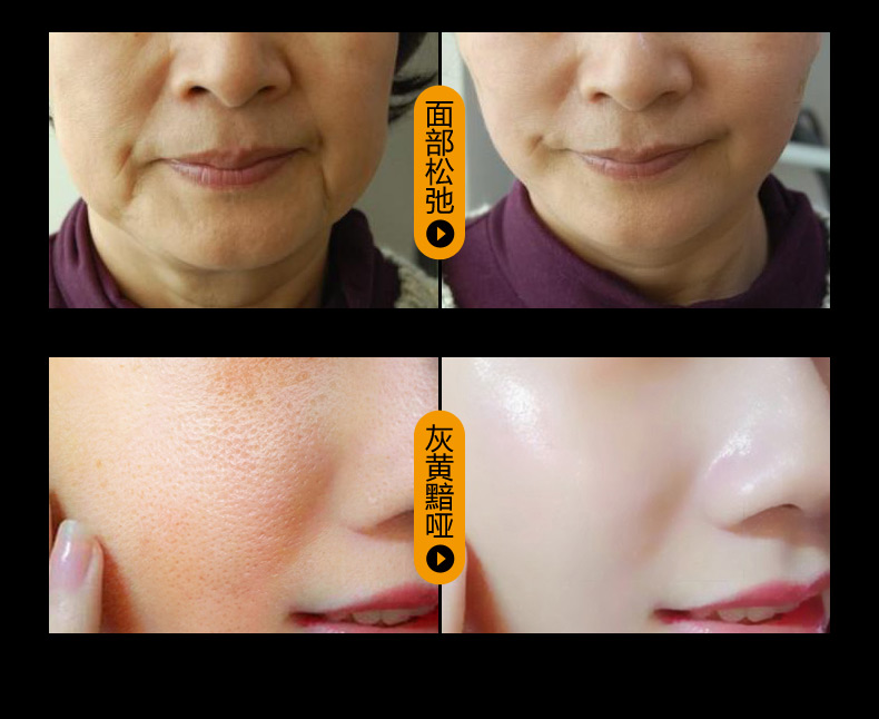 Thực phẩm cho da Liusheng Peptide Liquid Facial Serum Anti-nhăn Firming Desalination Wrinkle Head Rise serum trắng da mặt