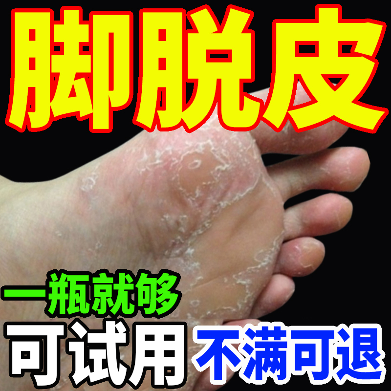 Special Cream for Peeling Skin on the Soles of the Feet, Rough and Dry Skin, and Removing Calluses