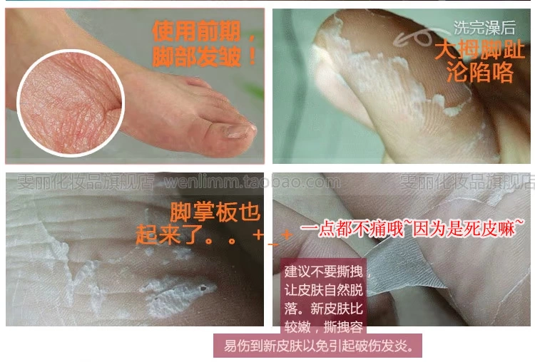 Một cặp lột chân phim tẩy tế bào chết tuổi sừng chân foot mask set dịu mắt cá chân chăm sóc bàn chân