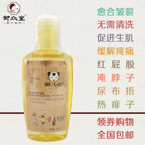 Yuzhongtang Yuertang Herbal Care Oil Nipple Baby Muscle Oil Promotes Wound Healing Neck Fart