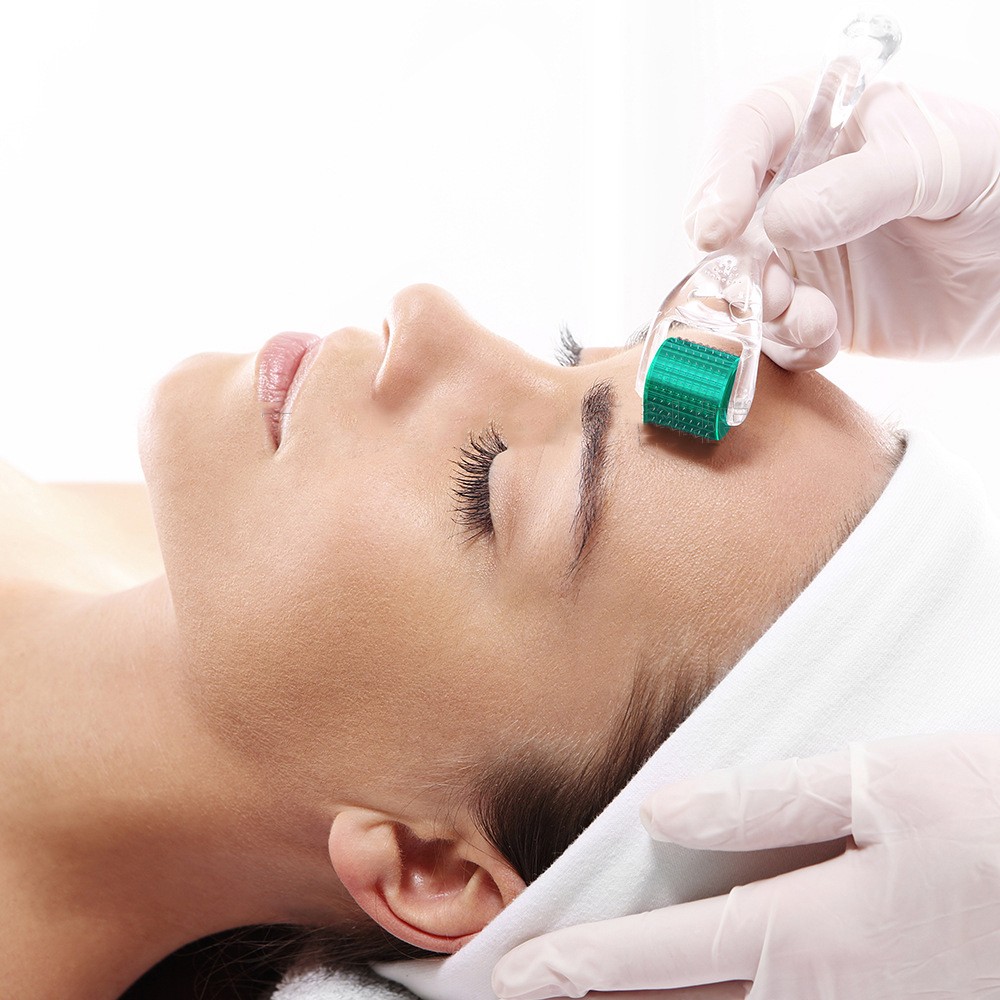 マイクロニードルローラー、保湿ニードルローラー、セルフトリートメントMTS、ストレッチマーク、閉鎖面皰、ニキビ跡、毛穴、小じわ、育毛