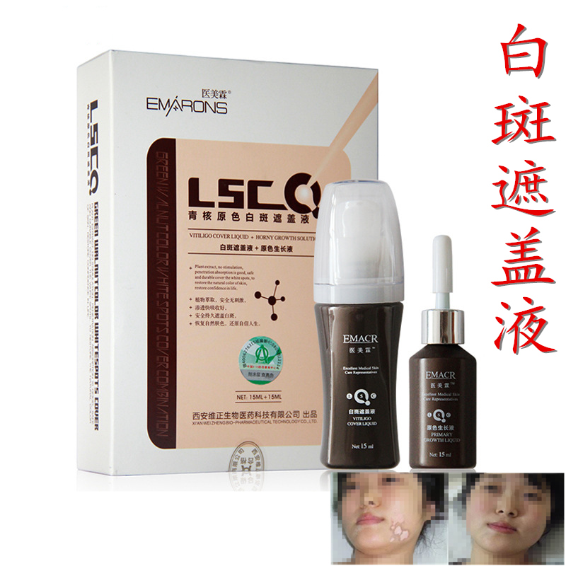 医美霖青核原色白斑遮盖液防汗持久霜防水型白斑外用修复遮瑕膏
