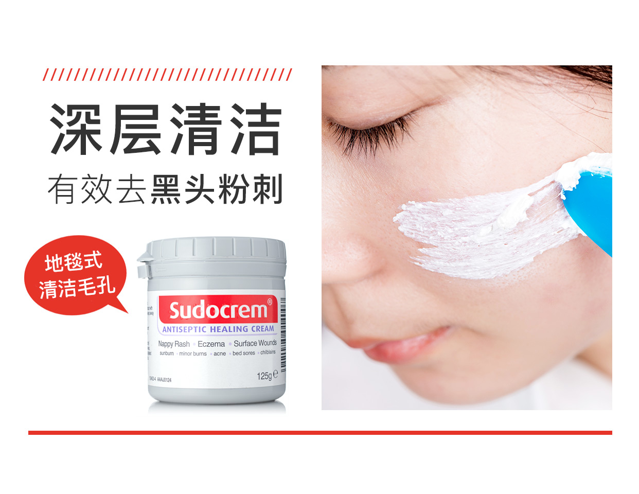 Sudocem British Butlete PP Kem nút trái trái để mụn đầu đen mụn thô lỗ mặt nạ làm sạch lỗ chân lông mặt nạ cho da nhạy cảm
