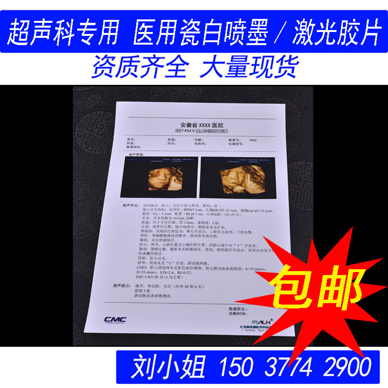 Porcelain white laser film porcelain white inkjet semi-transparent color gastroscope colonoscope B-ultrasound four-dimensional color ultrasound printing for hospitals