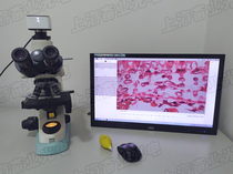 Nikon NIKON E100 trimesh digital biological microscope with 6.3 million pixel science grade CCD camera
