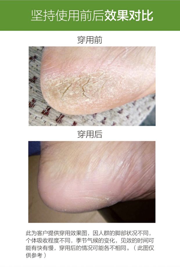 Vớ chống nứt Ziyan nữ tất dày chân dày cotton mùa xuân chân nứt tất nam không vớ chống chân chống khô - Vớ mắt cá chân tất lười