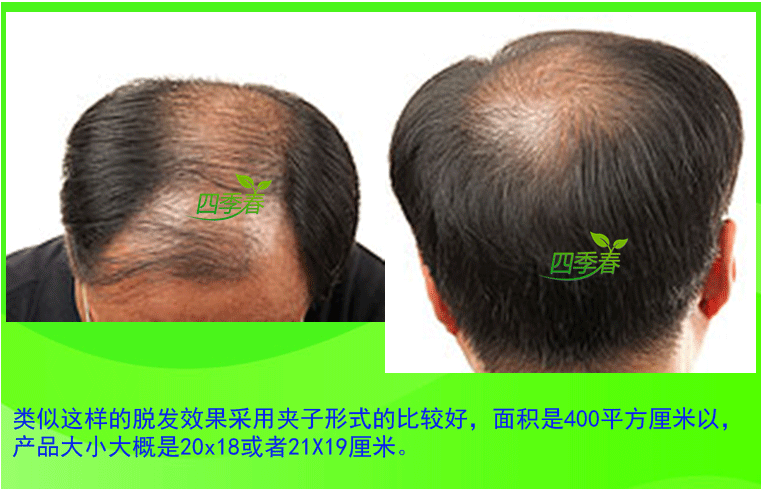 Extension mèches - Ref 224406 Image 9